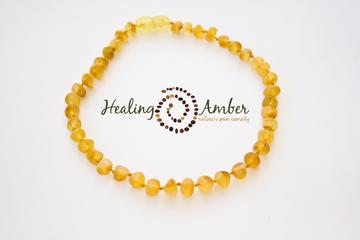 Healing Amber Necklace - 13 Inches